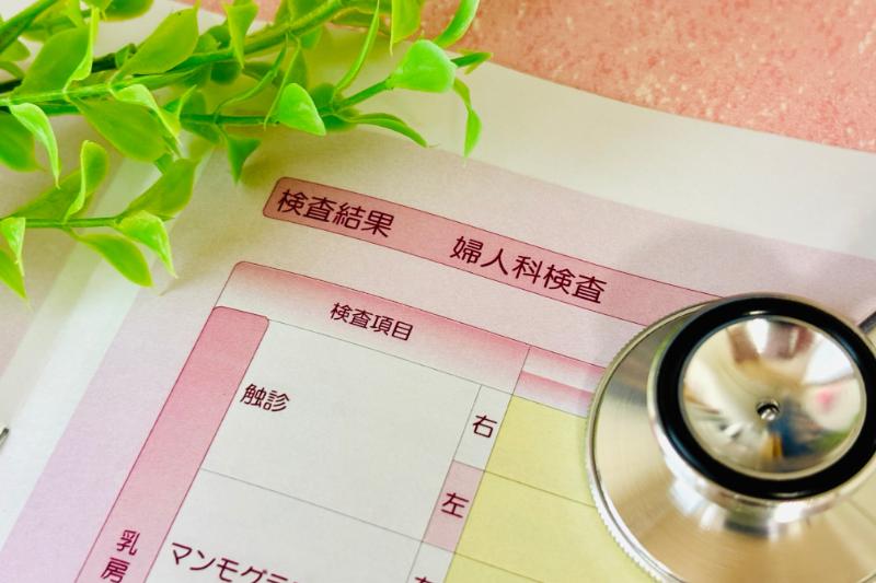 婦人科検診のイメージ
